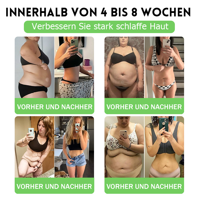 🇩🇪 𝑫𝑶𝑻𝑨𝑳𝑬® 𝑵𝒂𝒏𝒐 𝑴𝒊𝒄𝒓𝒐𝒏𝒆𝒆𝒅𝒍𝒆 𝑷𝒂𝒕𝒄𝒉 (𝑵𝒖𝒓 𝒆𝒊𝒏𝒎𝒂𝒍 𝒕ä𝒈𝒍𝒊𝒄𝒉 — 𝒔𝒊𝒄𝒉𝒕𝒃𝒂𝒓𝒆 𝑽𝒆𝒓ä𝒏𝒅𝒆𝒓𝒖𝒏𝒈𝒆𝒏 𝒊𝒏 7 𝑻𝒂𝒈𝒆𝒏) 𝑭𝒐𝒓𝒎𝒆𝒍 ✅ 𝑼𝒏𝒕𝒆𝒓𝒔𝒕ü𝒕𝒛𝒕 𝑺𝒕𝒐𝒇𝒇𝒘𝒆𝒄𝒉𝒔𝒆𝒍, 𝑮𝒆𝒘𝒊𝒄𝒉𝒕𝒔𝒎𝒂𝒏𝒂𝒈𝒆𝒎𝒆𝒏𝒕, 𝑯𝒆𝒓𝒛𝒈𝒆𝒔𝒖𝒏𝒅𝒉𝒆𝒊𝒕 𝒔𝒐𝒘𝒊𝒆 𝒃𝒆𝒊 𝑭𝒆𝒕𝒕𝒍𝒆𝒊𝒃𝒊𝒈𝒌𝒆𝒊𝒕, 𝒆𝒓𝒔𝒄𝒉𝒍𝒂𝒇𝒇𝒕𝒆𝒓 𝑯𝒂𝒖𝒕, 𝑫𝒊𝒂𝒃𝒆𝒕𝒆𝒔, 𝑺𝒄𝒉𝒍𝒂𝒇𝒂𝒑𝒏𝒐𝒆 𝒖𝒏𝒅 𝑮𝒆𝒍𝒆𝒏𝒌𝒑𝒓𝒐𝒃𝒍𝒆𝒎𝒆𝒏.